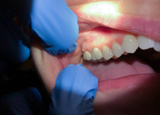 Best Emergency Orthodontic Repairs in Gravette, AR