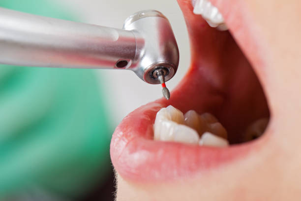 Best Broken or Chipped Tooth Repair in Gravette, AR